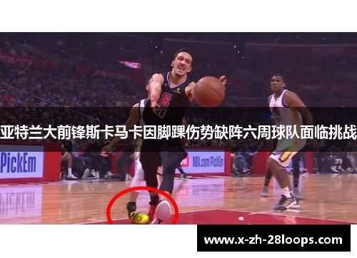 亚特兰大前锋斯卡马卡因脚踝伤势缺阵六周球队面临挑战